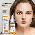 Turmeric Freckle Serum Whitening Dark Spots Organic Turmeric Oils Brighten Dark Skin Pigment Anti Aging Wrinkle Moisturizer (30ml) Whitening Serum Virgo Mart 